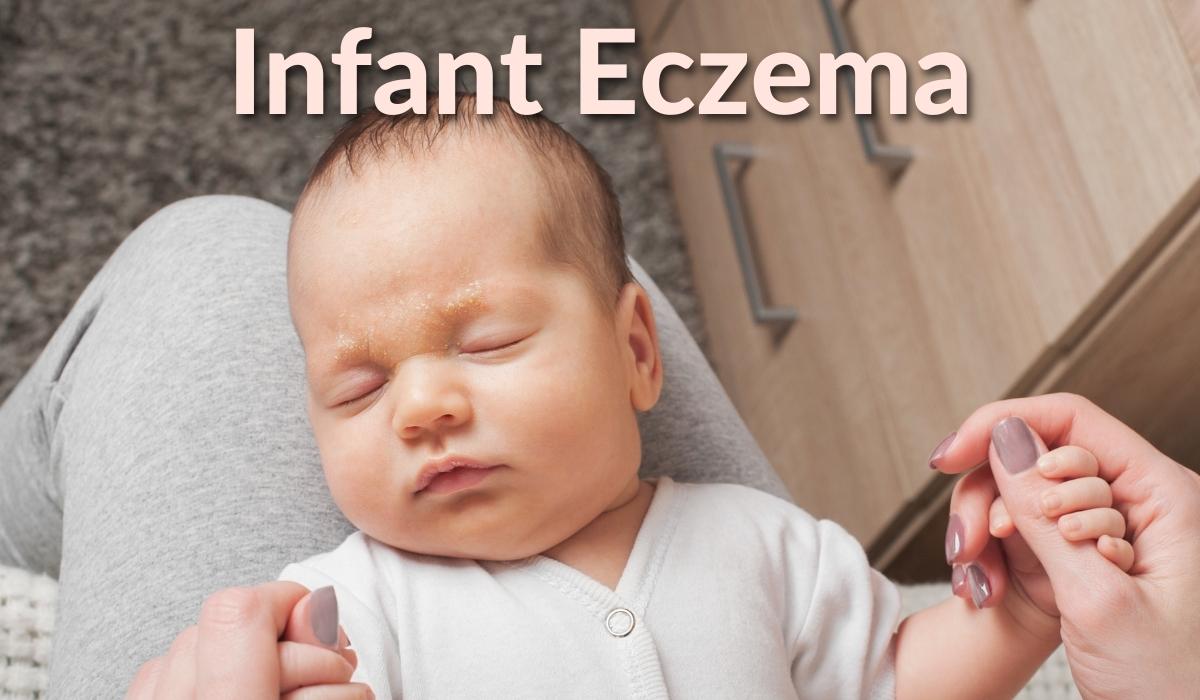 Infant Eczema - Possible Causes & Treatments