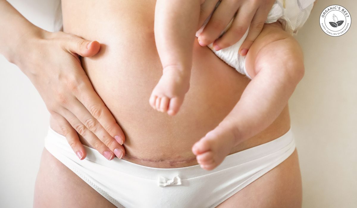 C-Section Recovery