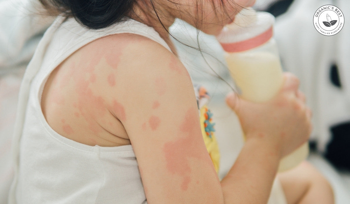 Understanding Cow Milk Protein Allergy in Babies: CMPA Formula Options